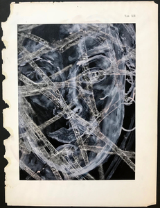 Alexandra Rutsch Brock Self Portraits gouache, ink on vintage Italian medical book page, microscopic photograph of germs