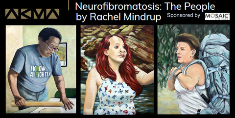 RACHEL MINDRUP Neurofibromatosis: The People, Paintings by Rachel Mindrup 